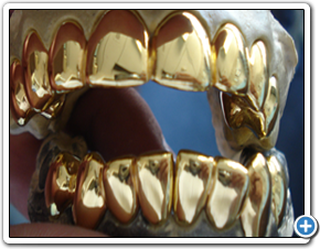 MIAMI GOLD GRILLZ